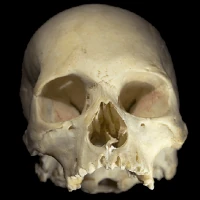 skull